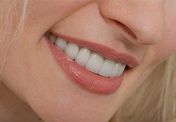  Closeup of healthy flawless smile