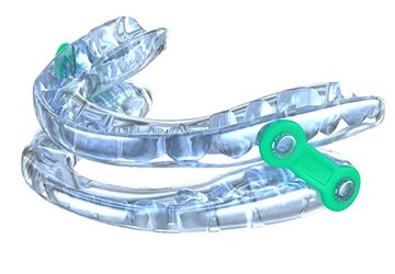 Example of oral appliance from Dental Excellence Melbourne